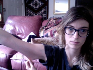 Image: Me, Beth, a 26-year-old thin, pale, white woman with blond-brown hair, purple glasses, blue eyes, and a black Beatles shirt. I am  stretching the skin on my right upper arm (on the lower/tricep part).